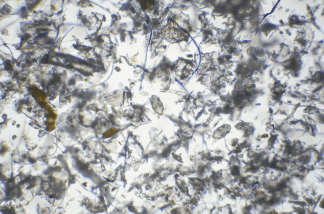 microscope view of dust mites and dust mite allergen